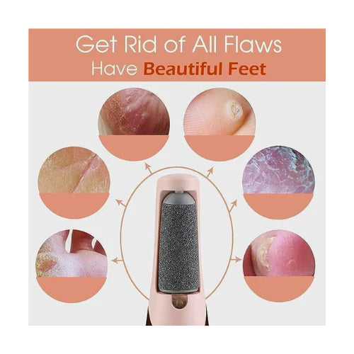 Electric Pedicure Foot File Callus Remover!