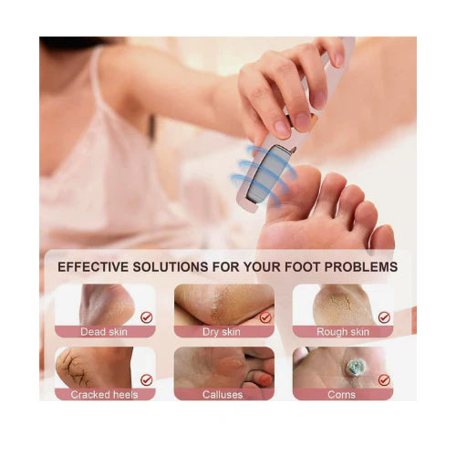 Electric Pedicure Foot File Callus Remover!