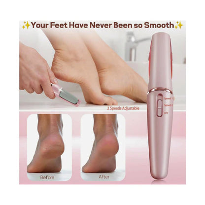 Electric Pedicure Foot File Callus Remover!